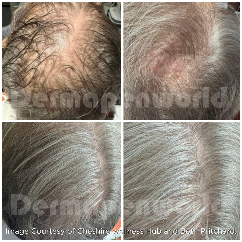 B A30012025 EXO-GROW Before After