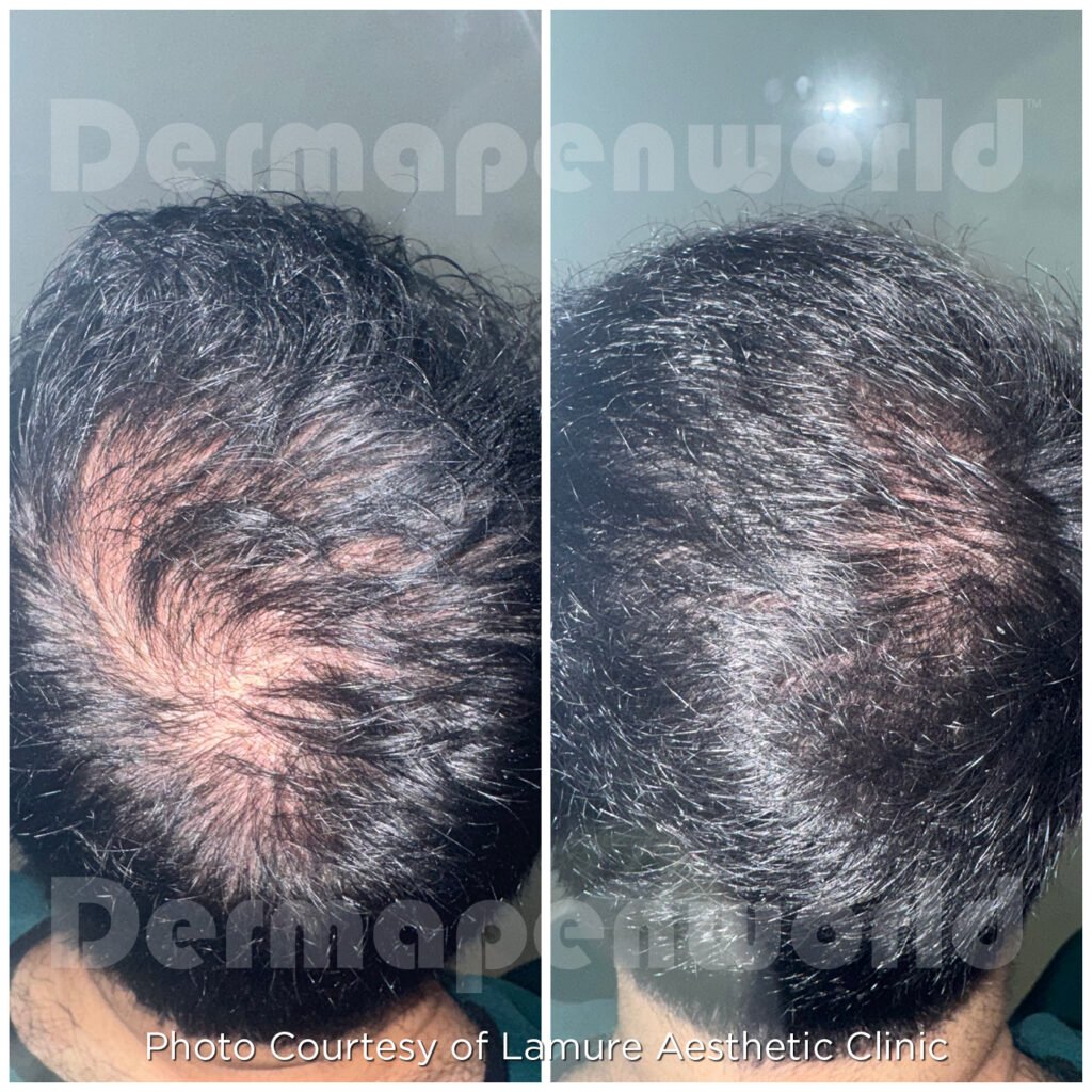 EXO_Client 131_Hair_Male-3
