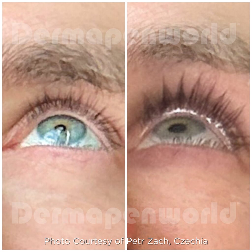 EXO_Client 132_Lash_Male